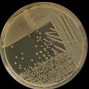 phân lập vi sinh vật trong đĩa petri